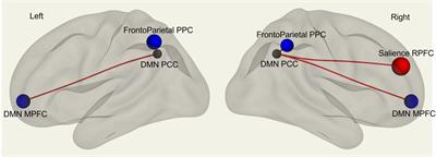 Sex differences in functional brain networks involved in interoception: An fMRI study
